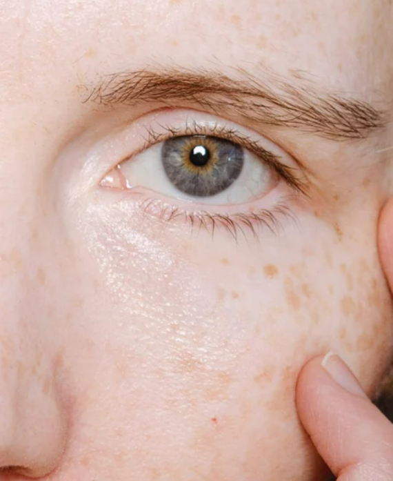 Retinol Alternative Eye Serum