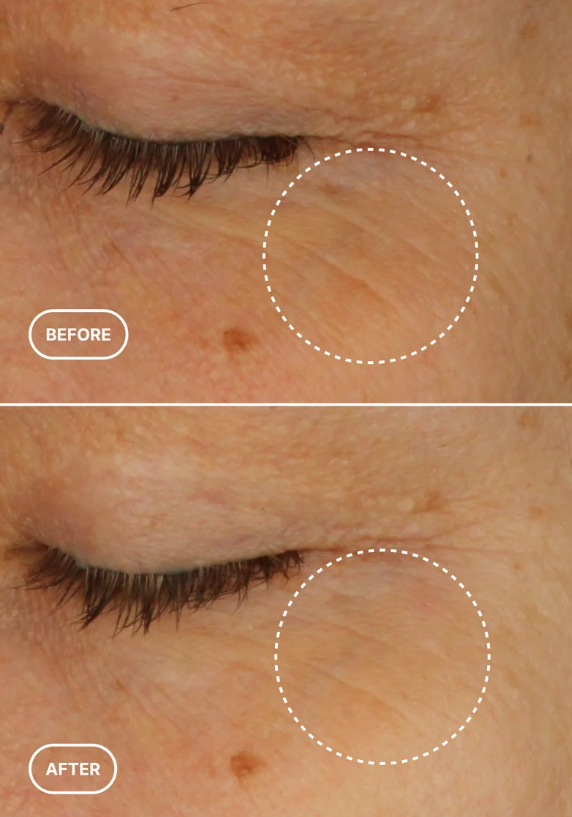 Retinol Alternative Eye Serum