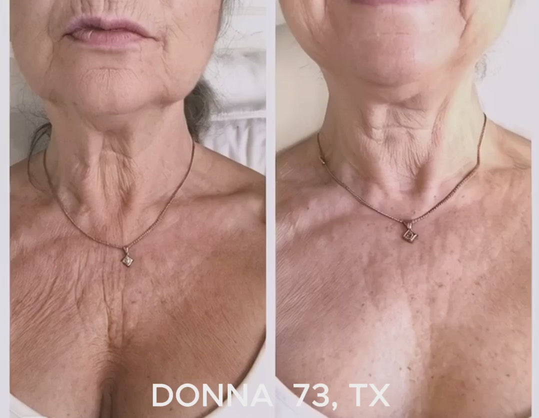 Flux Halo Evolved Radiance Collection Décolleté Patch